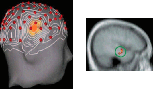 brain scan showing eureka moment
